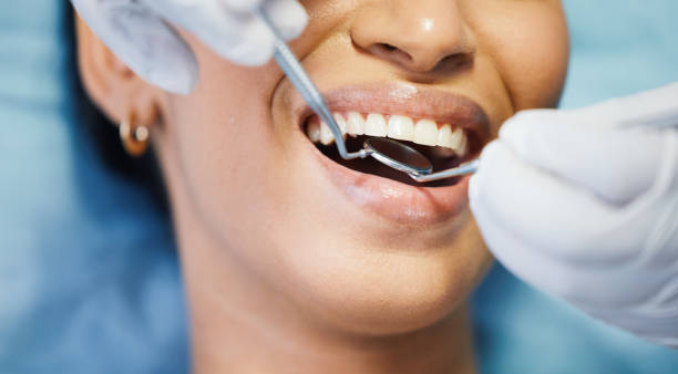 Best Root Canal Emergency Dentist  in Louisvle, IL