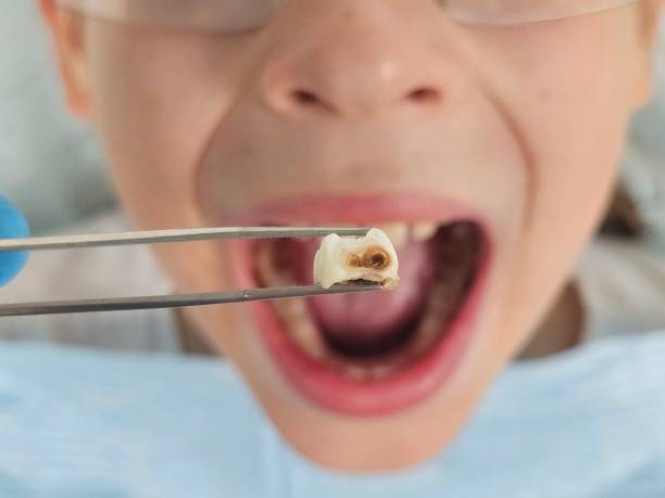 Best Broken Tooth Emergency  in Louisvle, IL